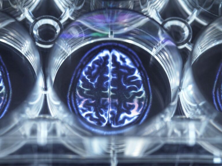 A glimpse into the human mind Brain scan visualization.